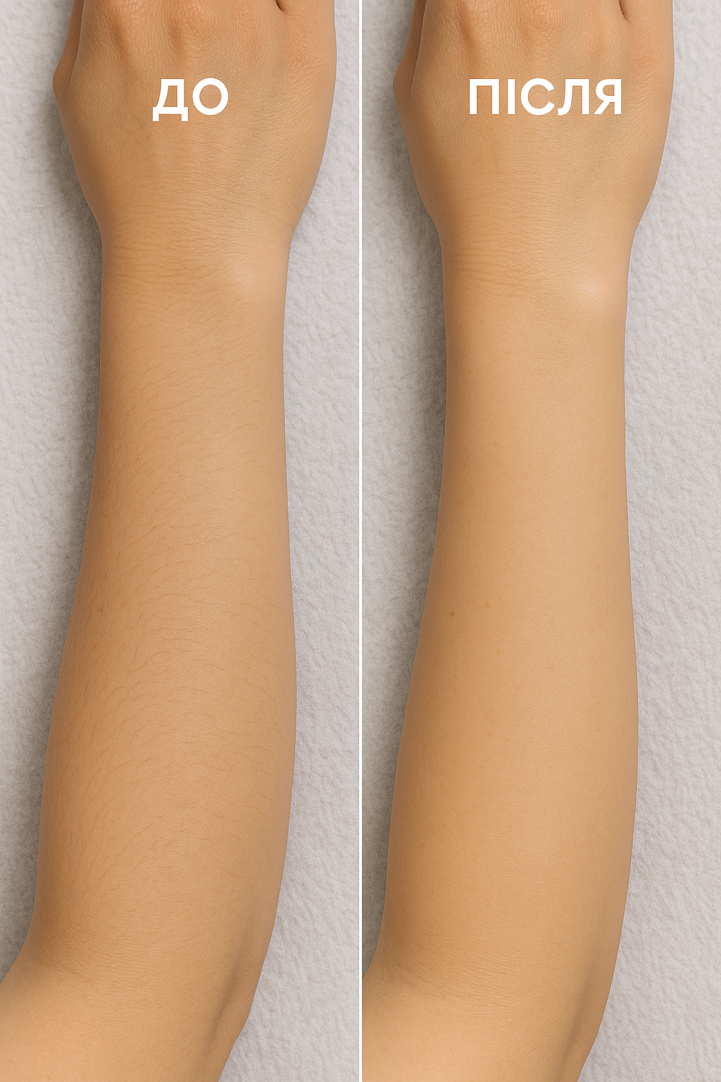 Шугарінг рук